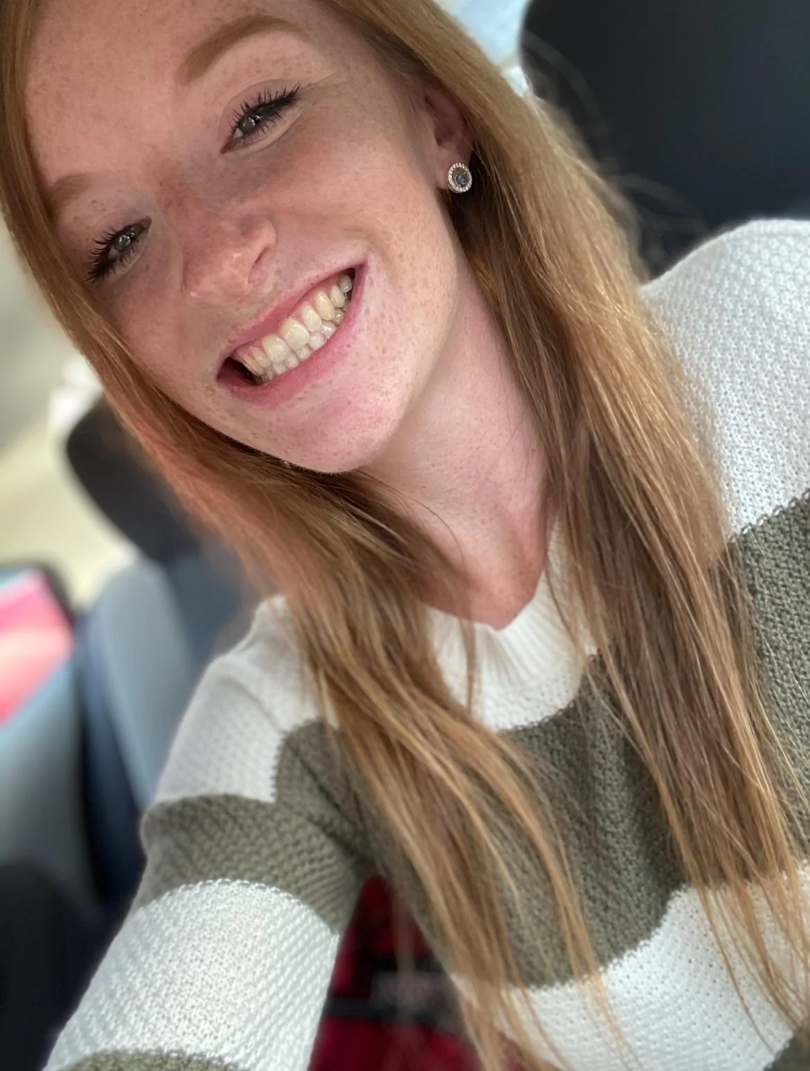 Have redheads ever been your type picture 1 of 1