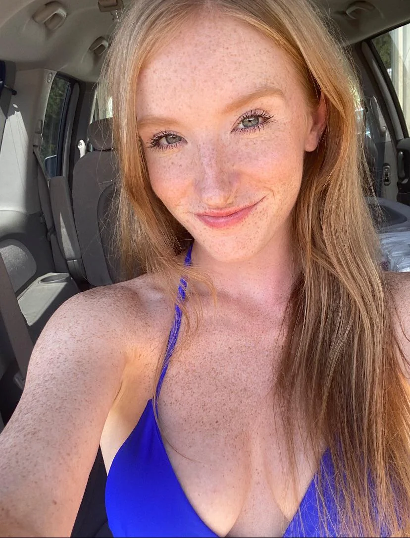 I hope you think all my freckles are cute picture 1 of 1