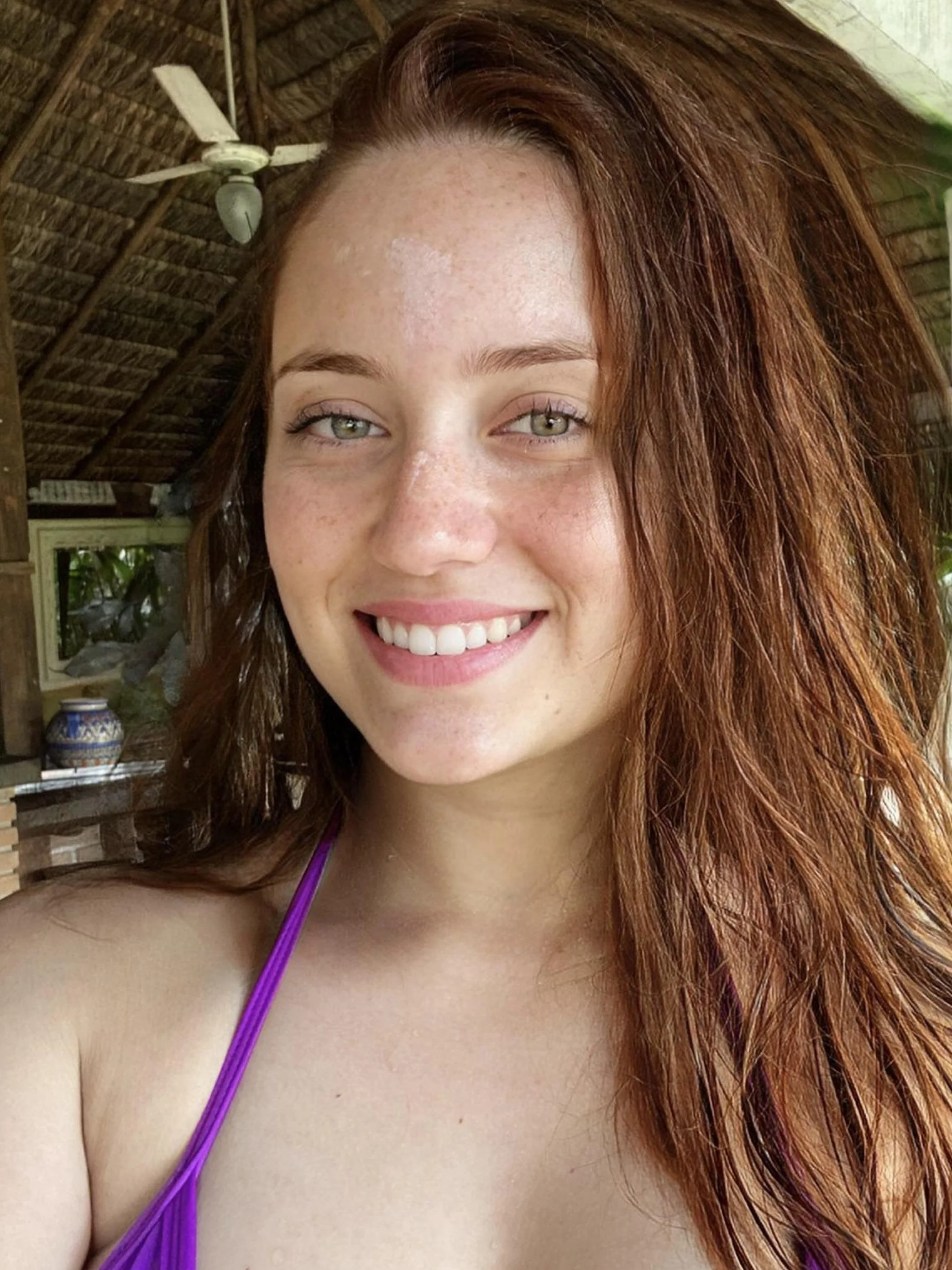 Smile and freckles to make you feel better picture 1 of 1