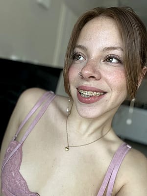 Pretty face with braces'