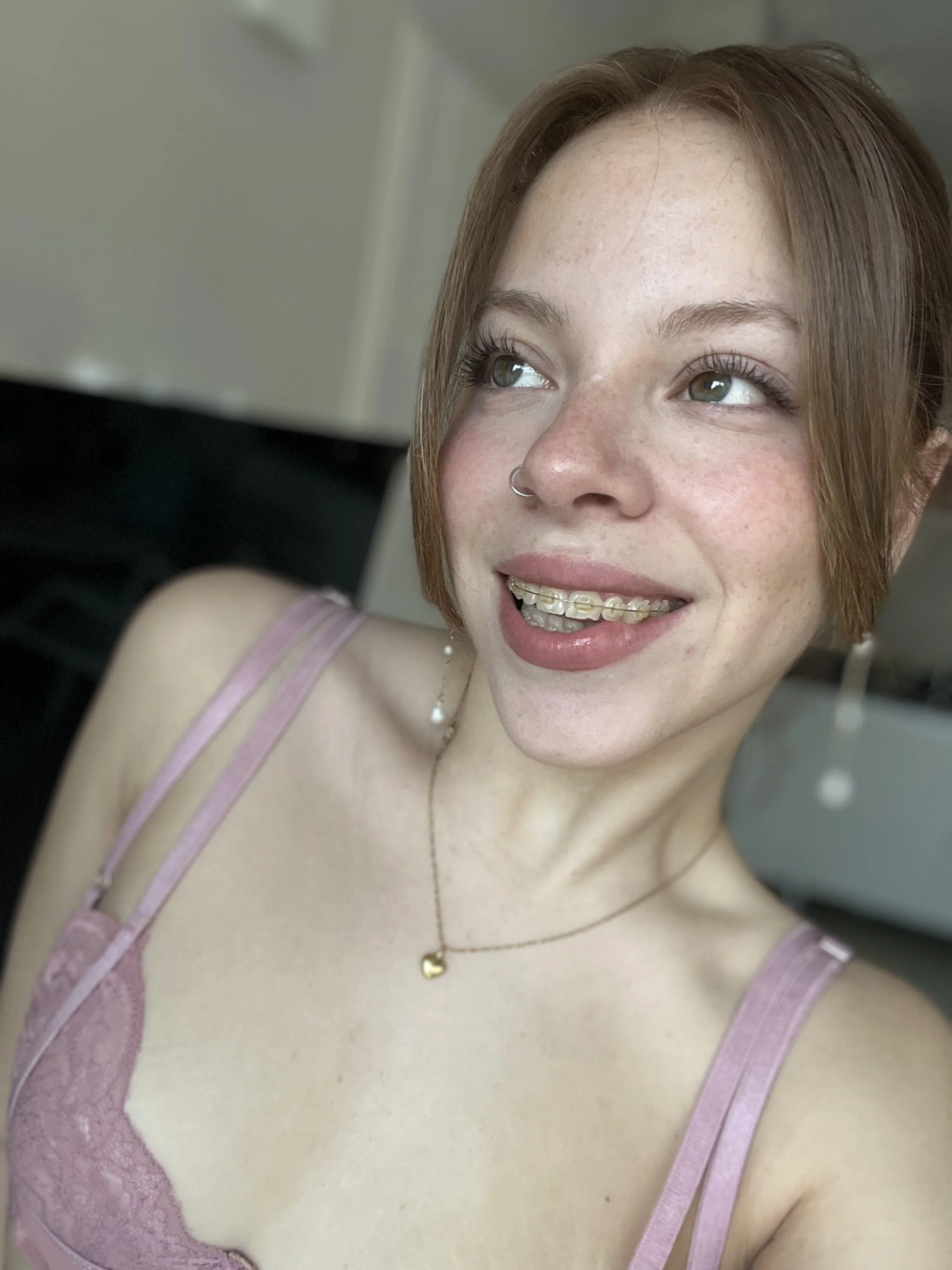 Pretty face with braces picture 1 of 1