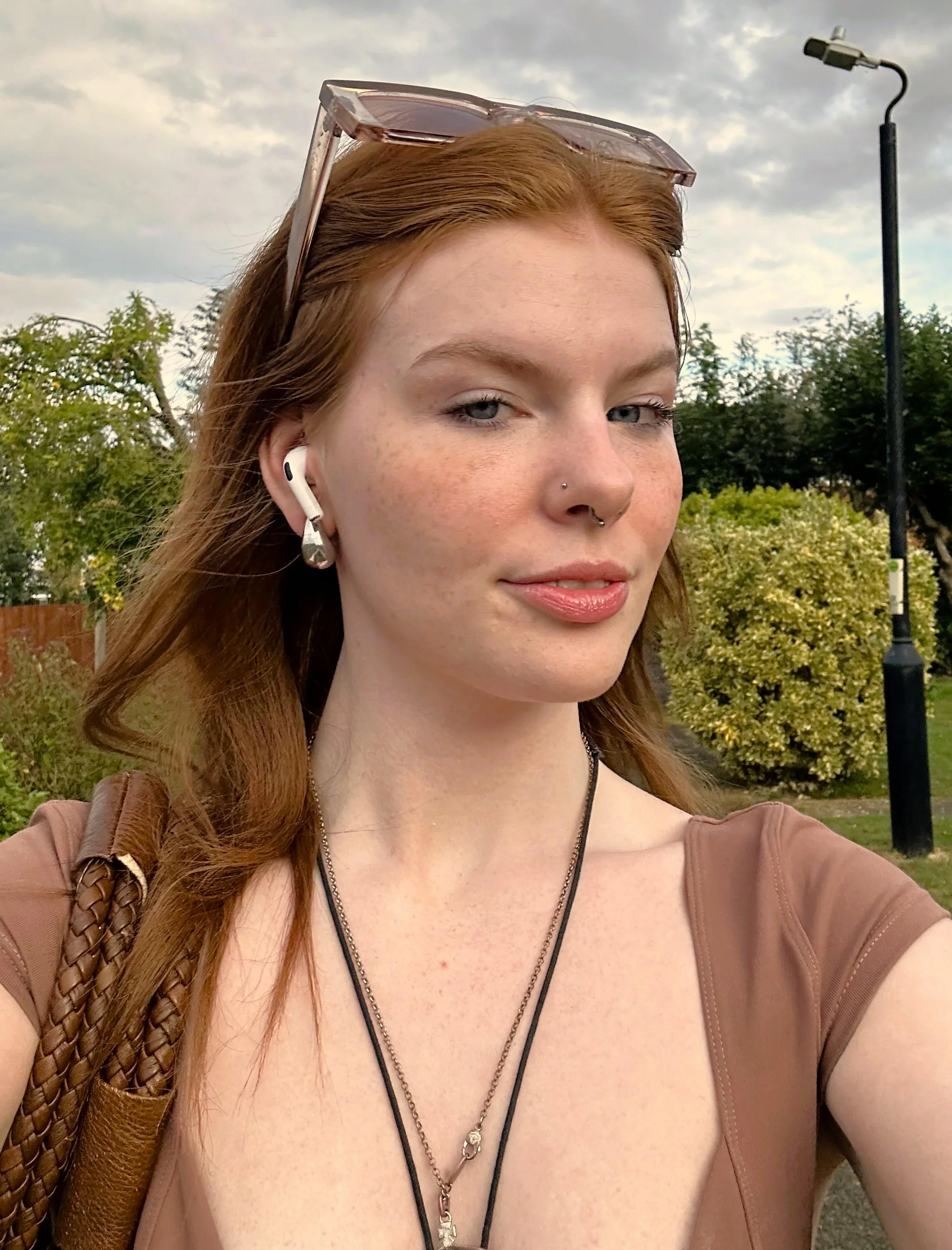 Am I still pretty even with freckles on? picture 1 of 1