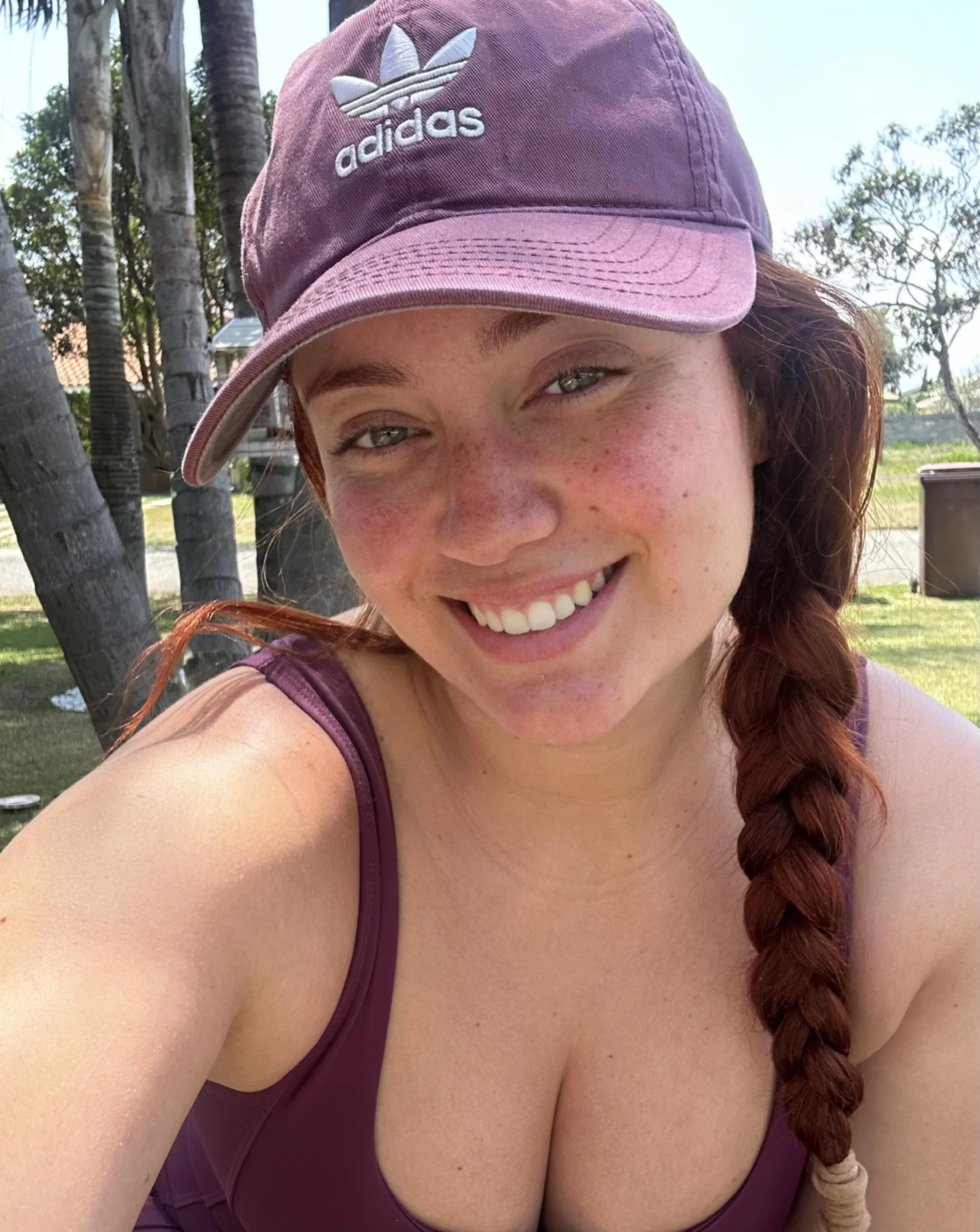 Freckles and smiles picture 1 of 1