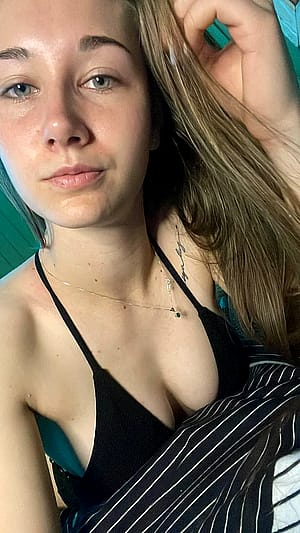 Enjoying My Skin Without Makeup'